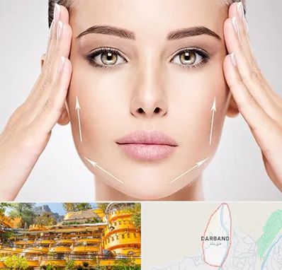 لیفت صورت در دربند