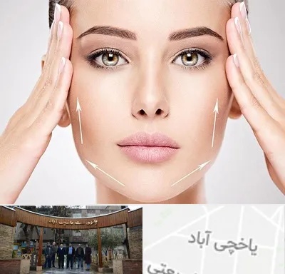 لیفت صورت در یاخچی آباد