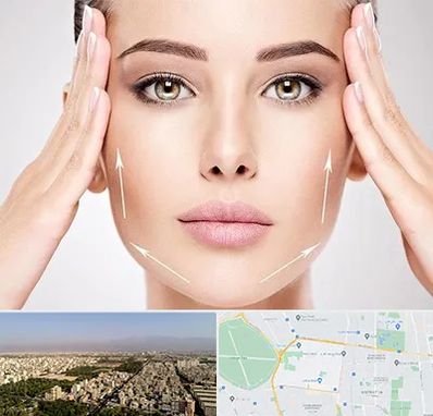 لیفت صورت در نازی آباد