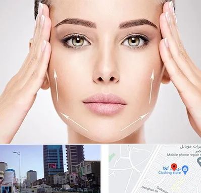 لیفت صورت در چهارراه طالقانی کرج