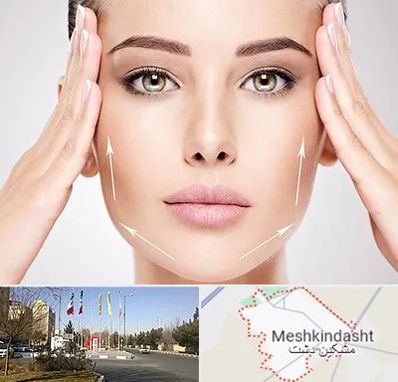 لیفت صورت در مشکین دشت