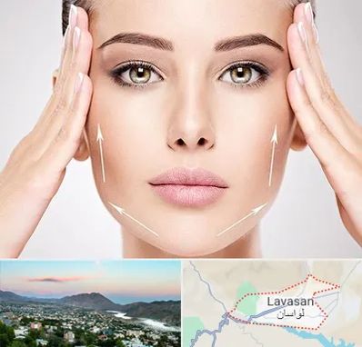 لیفت صورت در لواسان