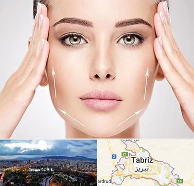 لیفت صورت در تبریز
