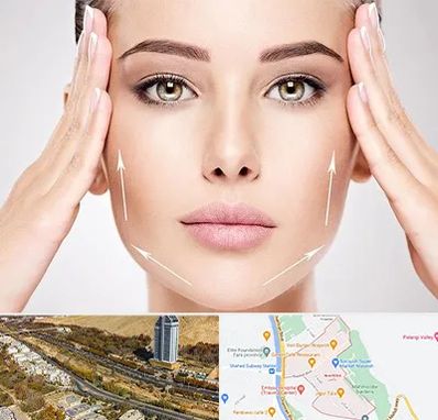 لیفت صورت در خیابان نیایش شیراز