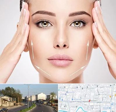 لیفت صورت در ضیابری رشت