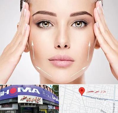 لیفت صورت در امین حضور