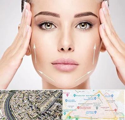 لیفت صورت در شهرک غرب مشهد