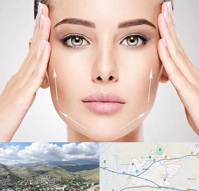 لیفت صورت در رودهن