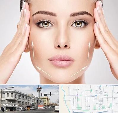 لیفت صورت در 17شهریور