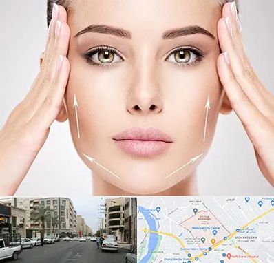 لیفت صورت در زیتون کارمندی اهواز