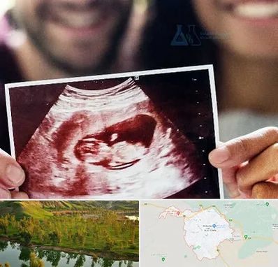 غربال گری در بهبهان