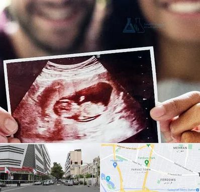 غربال گری در بلوار فردوس 