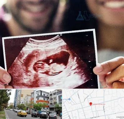 غربال گری در هفده شهریور تبریز