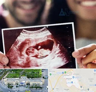 غربال گری در نسیم شهر