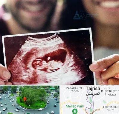 غربال گری در تجریش 