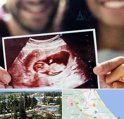 غربال گری در رودسر