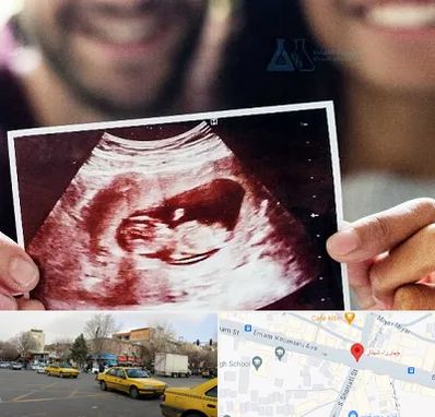 غربال گری در شهناز تبریز