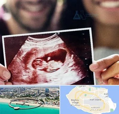 غربال گری در کیش