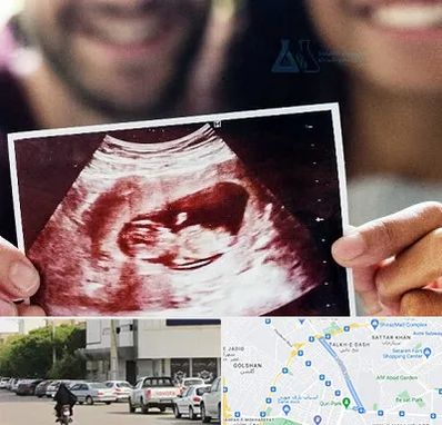 غربال گری در قدوسی شرقی شیراز