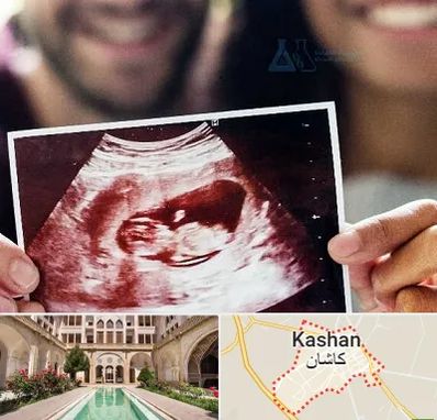 غربال گری در کاشان