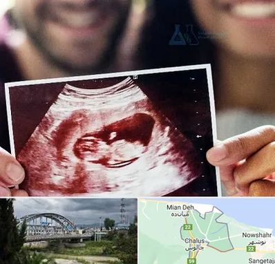 غربال گری در چالوس