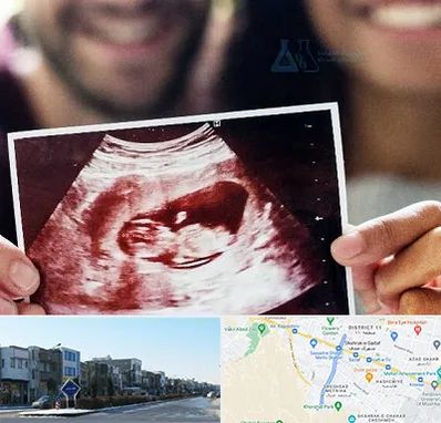 غربال گری در شریعتی مشهد