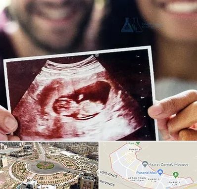 غربال گری در پرند