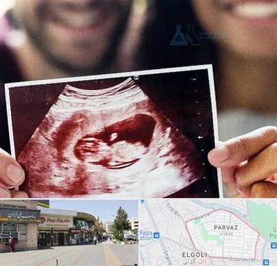 غربال گری در پرواز تبریز