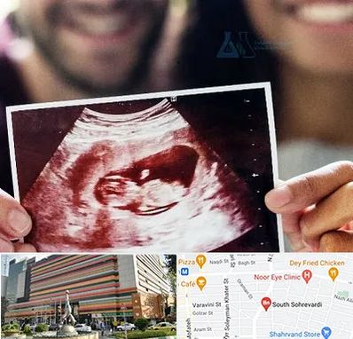 غربال گری در سهروردی 