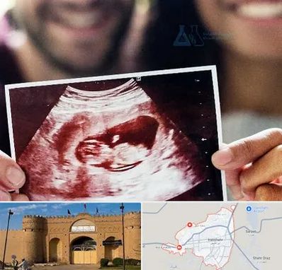 غربال گری در ایرانشهر