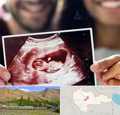 غربال گری در خاش