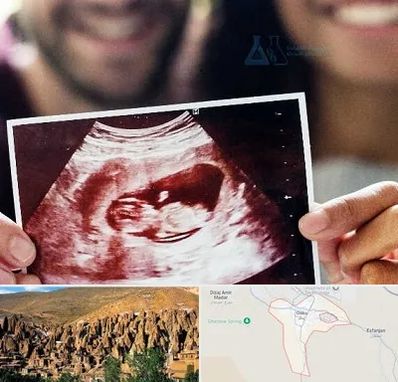 غربال گری در اسکو