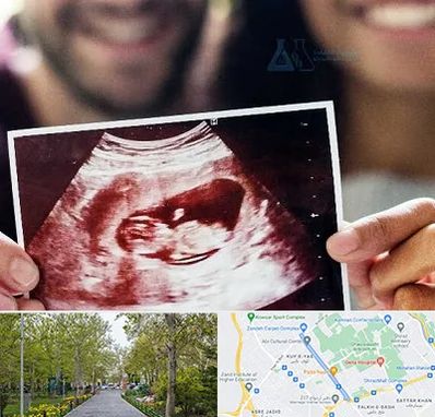 غربال گری در قدوسی غربی شیراز