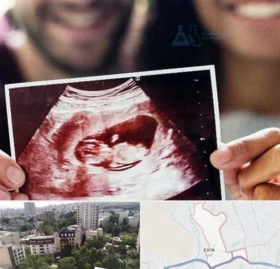 غربال گری در اوین