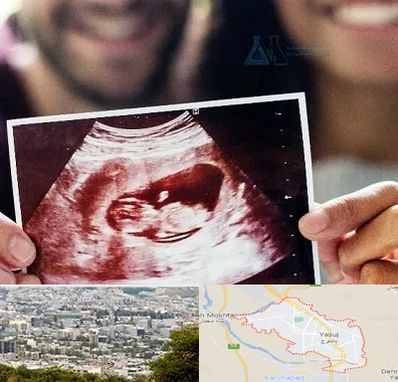 غربال گری در یاسوج