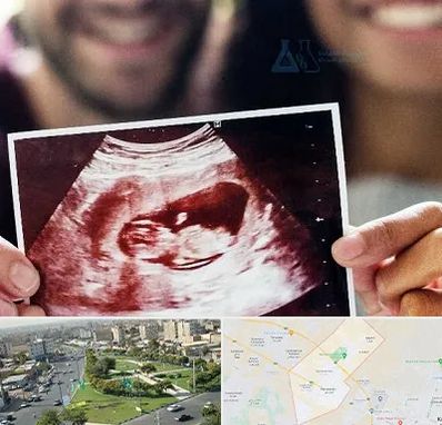 غربال گری در کمال شهر کرج