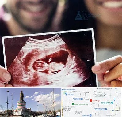 غربال گری در کارگر جنوبی