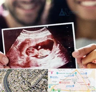 غربال گری در شهرک غرب مشهد