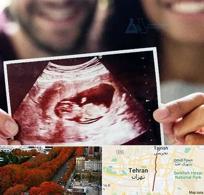 غربال گری در ولیعصر 