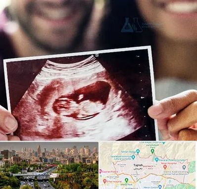 غربال گری در منطقه 1 تهران