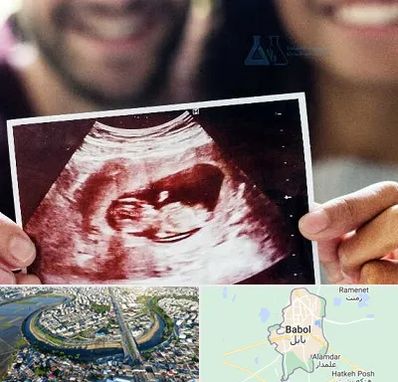 غربال گری در بابل