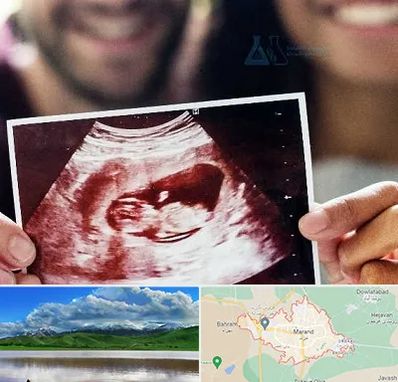 غربال گری در مرند