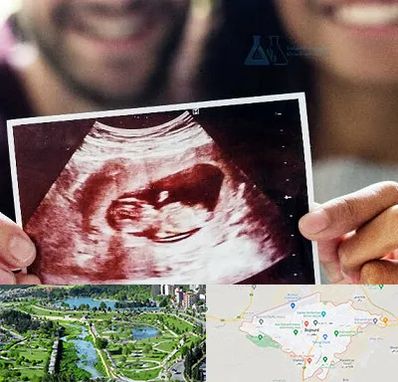 غربال گری در بجنورد