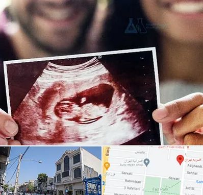 غربال گری در افسریه 