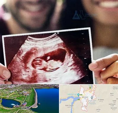 غربال گری در مهاباد