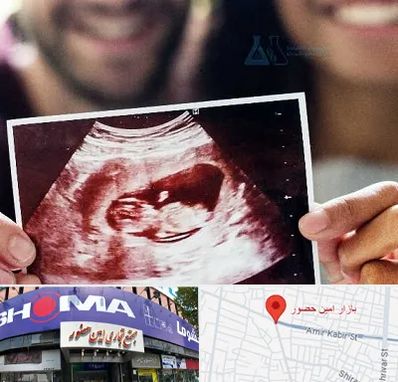 غربال گری در امین حضور