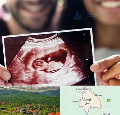 غربال گری در آمل