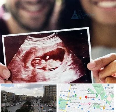 غربال گری در بلوار فردوسی مشهد