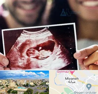 غربال گری در میانه