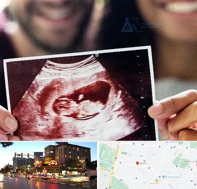 غربال گری در بلوار سجاد مشهد